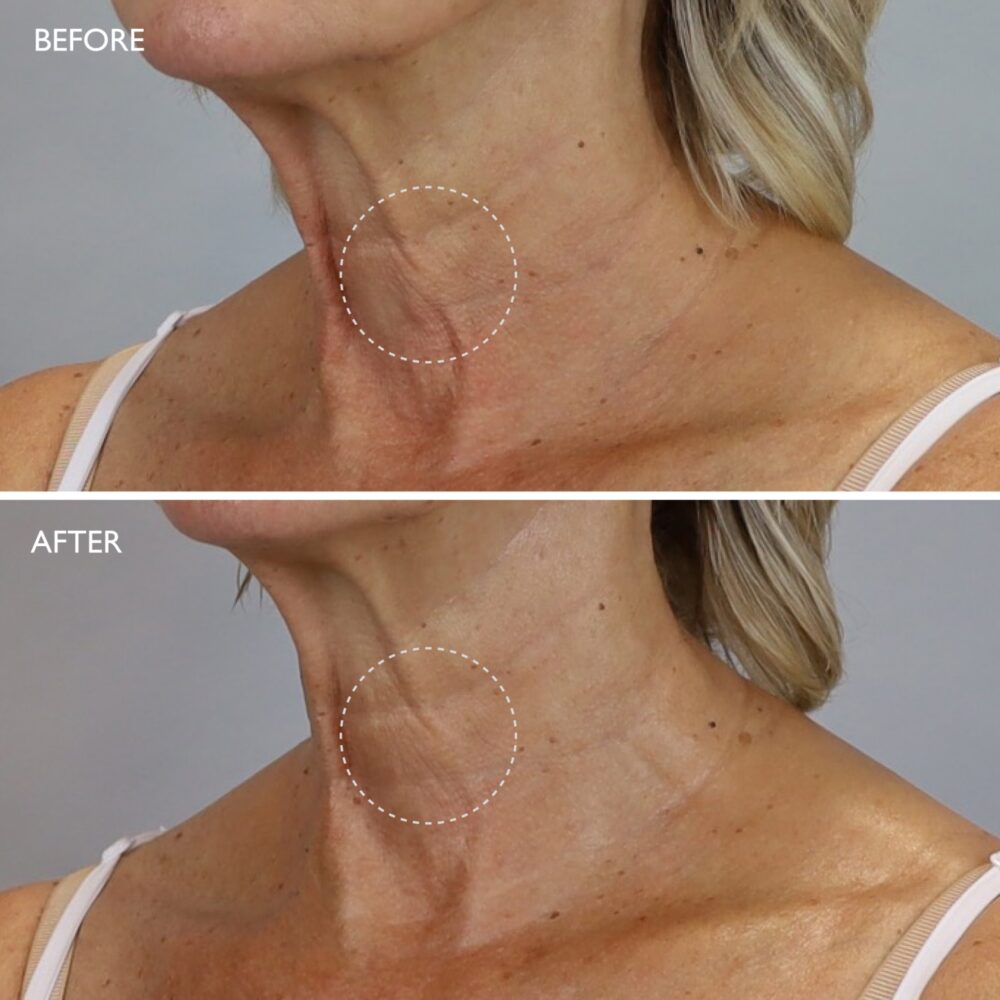 AGE BENEFIT Neck & Décolleté Cream 3